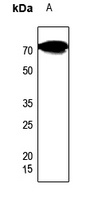 CES2 Rabbit Polyclonal Antibody