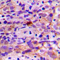 CES2 Rabbit Polyclonal Antibody