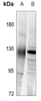 Neuropilin 1 Rabbit Polyclonal Antibody