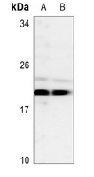 TSC22 Rabbit Polyclonal Antibody