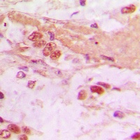 TSC22 Rabbit Polyclonal Antibody