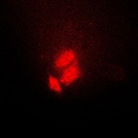 TSC22 Rabbit Polyclonal Antibody