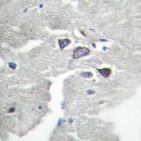 CDK5R1 p35 Rabbit Polyclonal Antibody