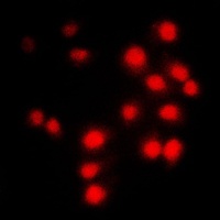 Cyclin A1/2 Rabbit Polyclonal Antibody