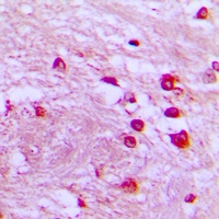 p39 Rabbit Polyclonal Antibody