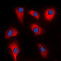 p39 Rabbit Polyclonal Antibody