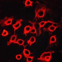 CCRL2 Antibody