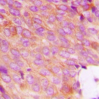 DOK2 (Phospho-Y299) Antibody