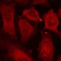 DOK2 (Phospho-Y299) Antibody