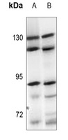 ARHGEF1 Rabbit Polyclonal Antibody