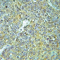 ARHGEF1 Rabbit Polyclonal Antibody