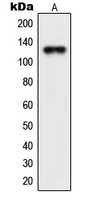 NEMF Rabbit Polyclonal Antibody