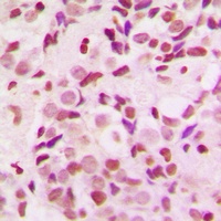 NEMF Rabbit Polyclonal Antibody