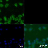NEMF Rabbit Polyclonal Antibody