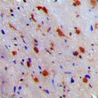 NEURL1 Rabbit Polyclonal Antibody