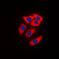 NEURL1 Rabbit Polyclonal Antibody