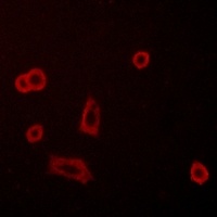 GPR50 Rabbit Polyclonal Antibody
