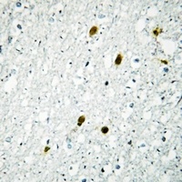 MSK1 (Phospho-T581) Antibody