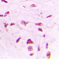 STK17B Antibody