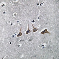PAHT Antibody