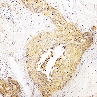 COX5A Rabbit Polyclonal Antibody