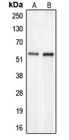 CHST2 Rabbit Polyclonal Antibody