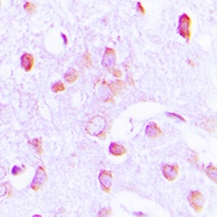 PERK Rabbit Polyclonal Antibody