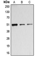 BAGE5 Rabbit Polyclonal Antibody