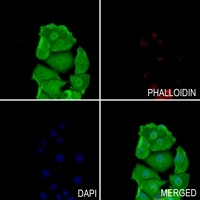 BAGE5 Rabbit Polyclonal Antibody
