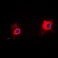 PIG11 Rabbit Polyclonal Antibody
