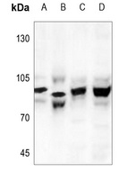 CHD1L Rabbit Polyclonal Antibody