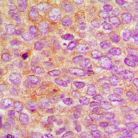 Nephrocystin 5 Rabbit Polyclonal Antibody