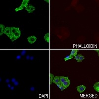 Nephrocystin 5 Rabbit Polyclonal Antibody