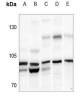 N4BP1 Antibody
