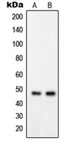 GPRIN2 Rabbit Polyclonal Antibody