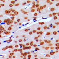 GPRIN2 Rabbit Polyclonal Antibody