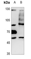 TLK1 Rabbit Polyclonal Antibody