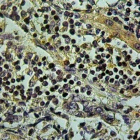 TLK1 Rabbit Polyclonal Antibody