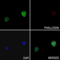 TLK1 Rabbit Polyclonal Antibody