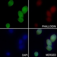 ZC3H11A Rabbit Polyclonal Antibody