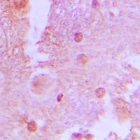 AS160 (Phospho-T642) Antibody