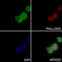 OXSR1 Rabbit Polyclonal Antibody