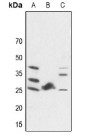 FGF19 Rabbit Polyclonal Antibody
