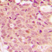 Histone Deacetylase 5 (Phospho-S498) Antibody