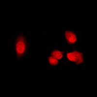 Histone Deacetylase 5 (Phospho-S498) Antibody