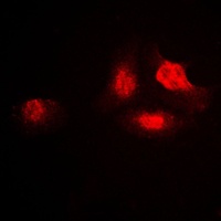 UBA2 Antibody