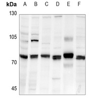 FARSB Rabbit Polyclonal Antibody