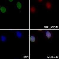 FARSB Rabbit Polyclonal Antibody