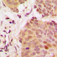 G3BP1 Rabbit Polyclonal Antibody