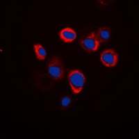 Renin Receptor Rabbit Polyclonal Antibody